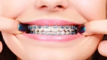 7 Facts You Need To Know About Orthodontics