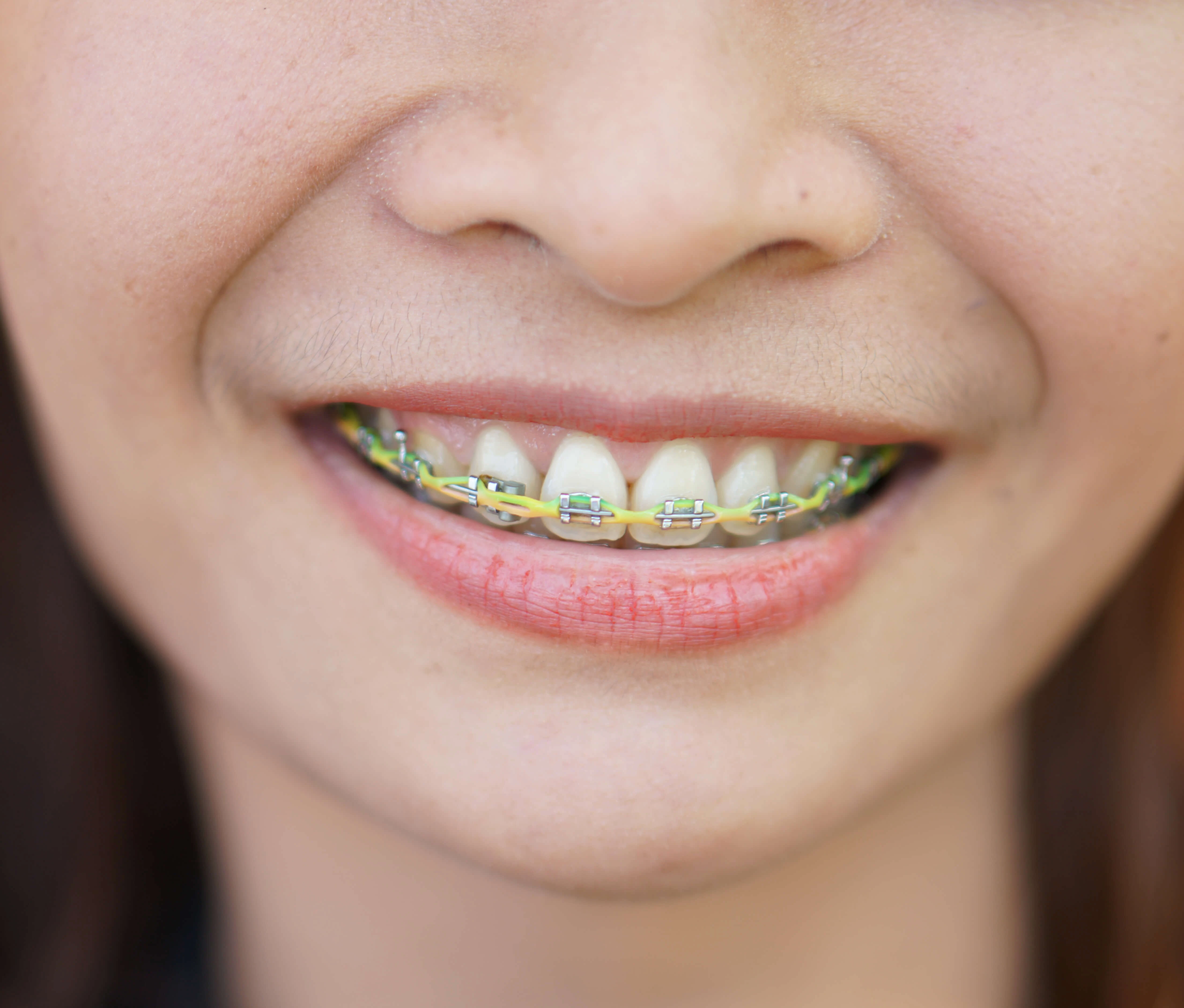 2024 Orthodontics Cost in US