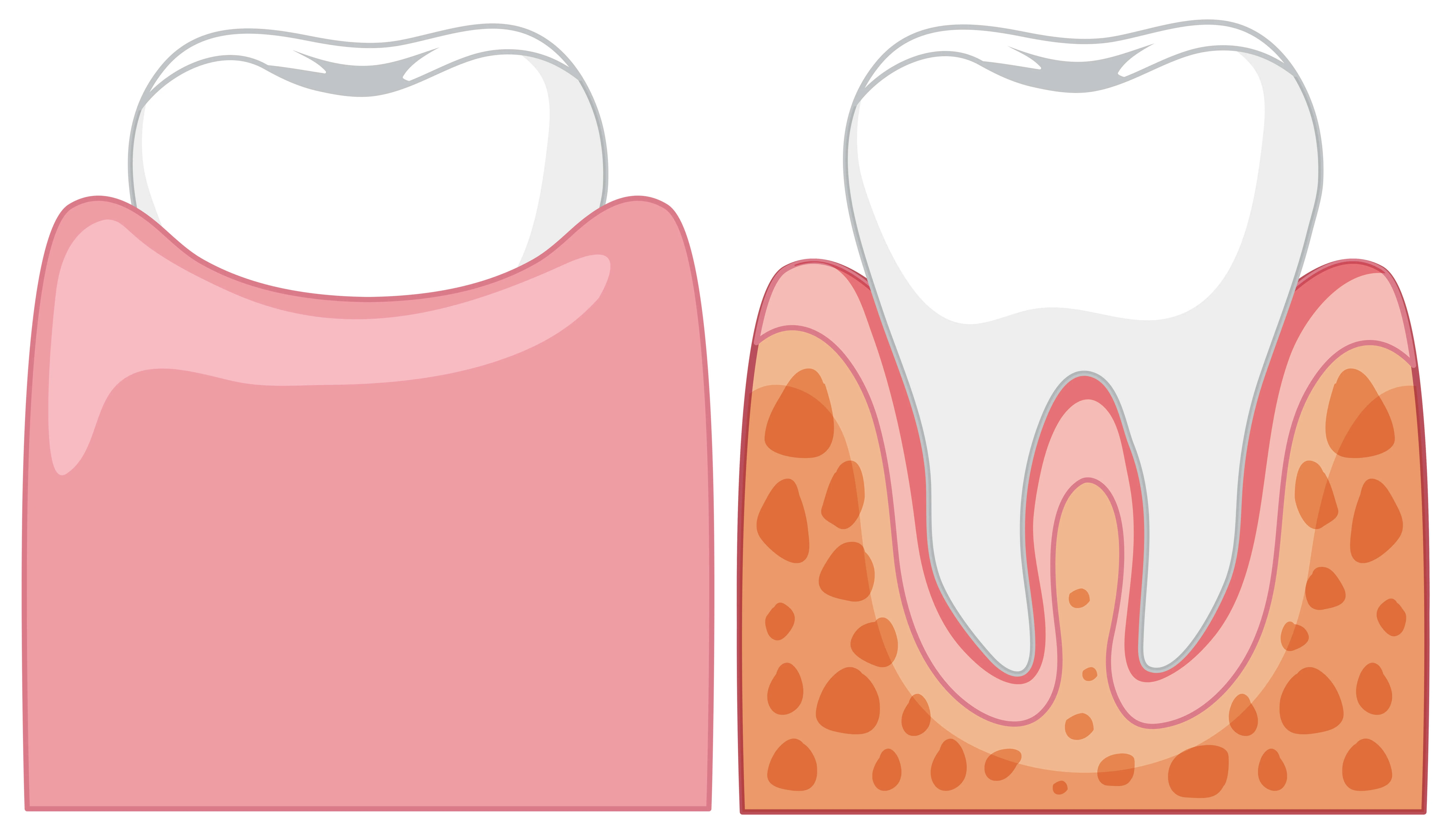 What should you look for when shopping for dental insurance?