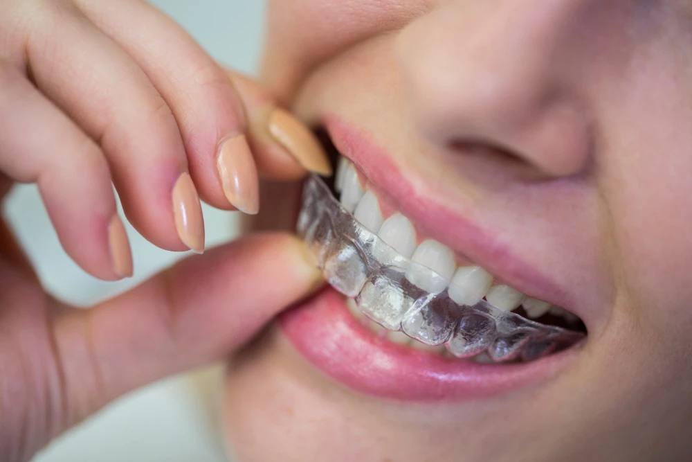 Why Timing Matters in Orthodontics