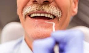 Dental Implants For Seniors : Benefits and Considerations